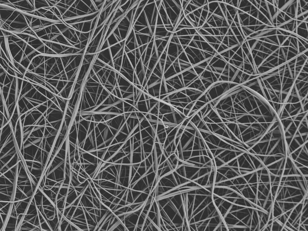 Scanning electron micrograph of Tissuelock fibers